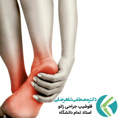 درمان صافی کف پا به روش جراحی