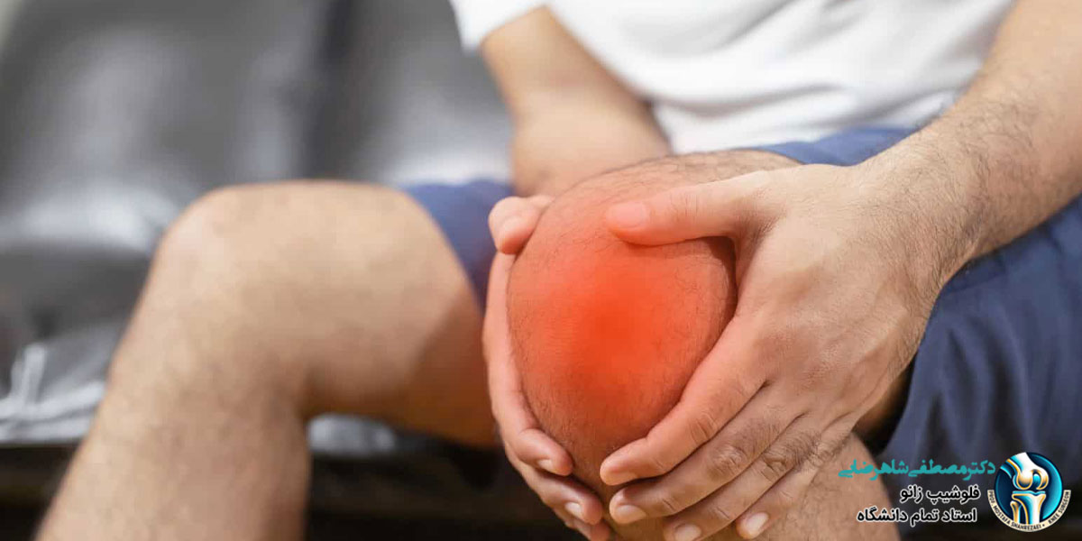 نقرس زانو چیست