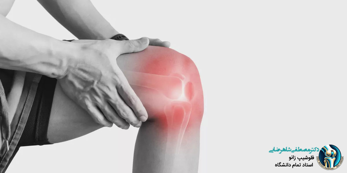 علت درد زانو چیست