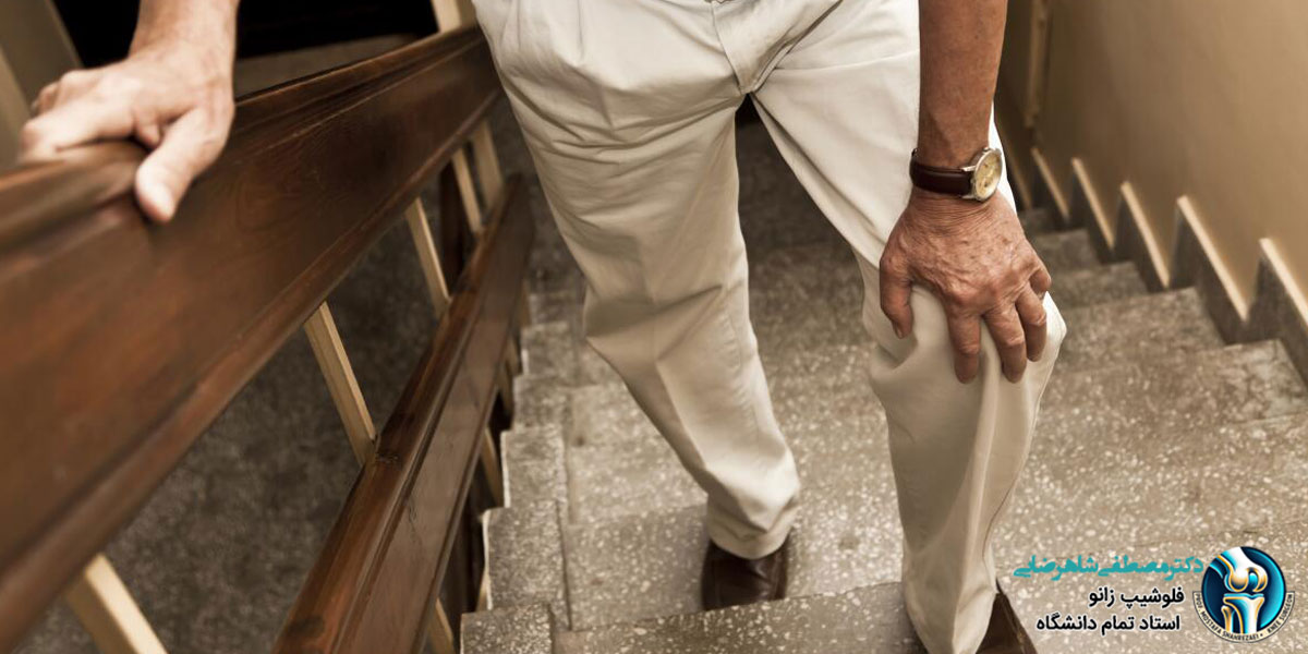 زانو درد زمان بالا رفتن از پله ها