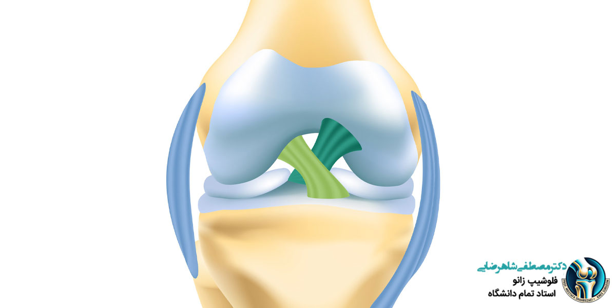 انواع آسیب به رباط زانو
