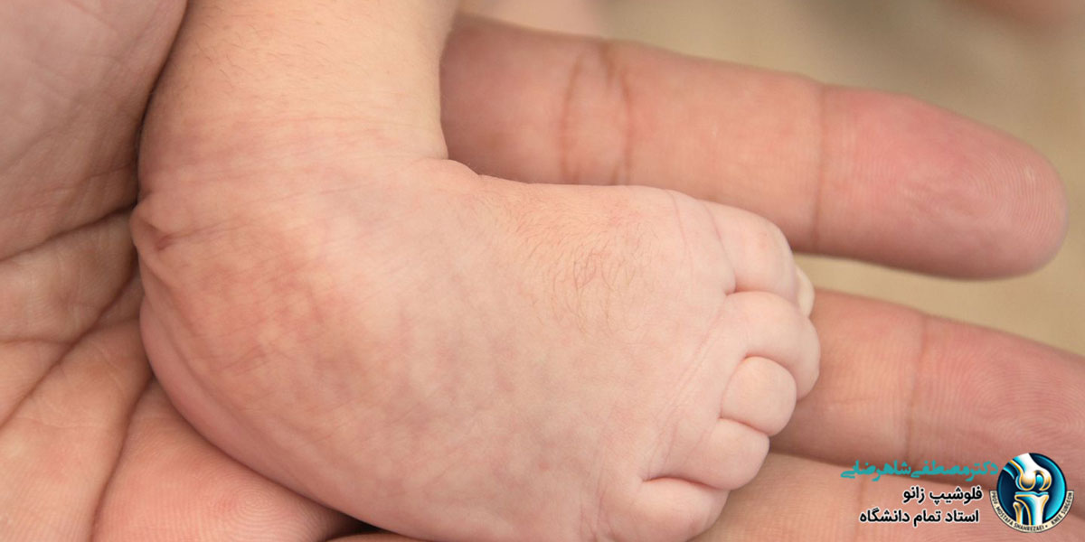 پاچنبری یا کلاب فوت چیست