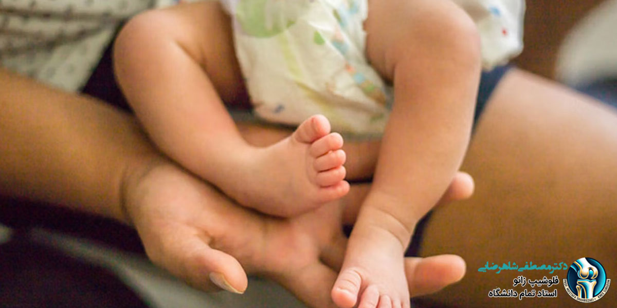 پاچنبری یا کلاب فوت چیست