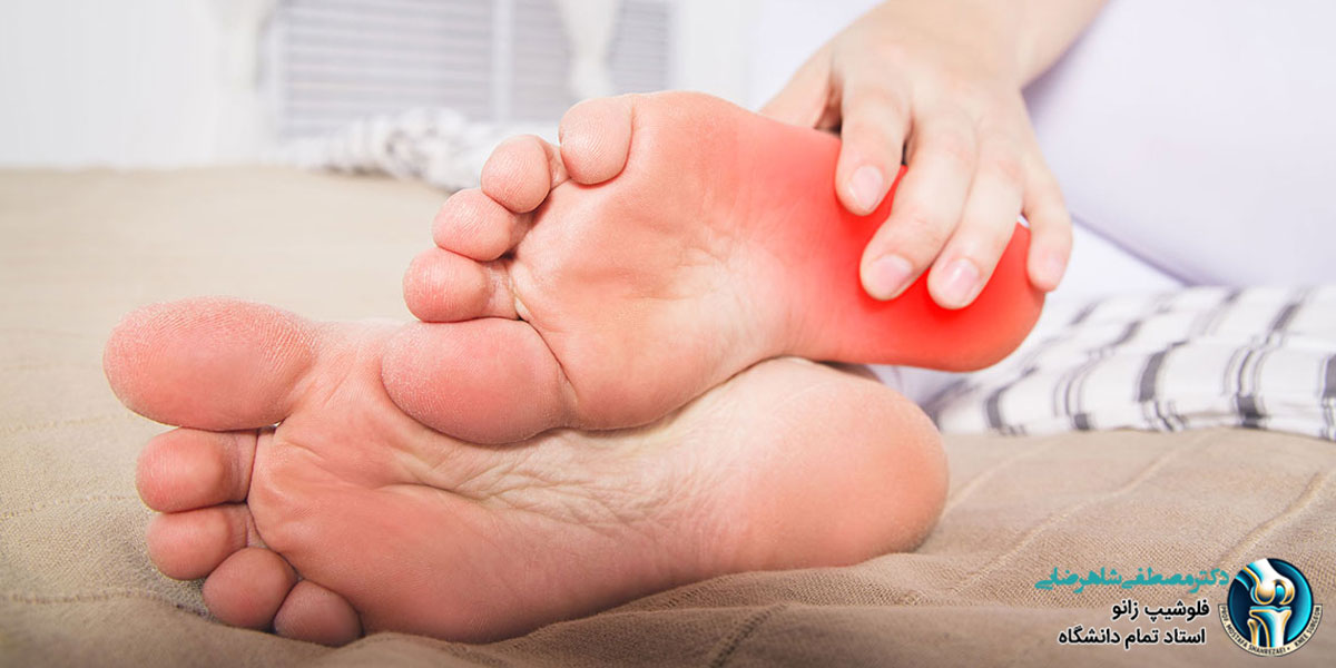 خار پاشنه چیست