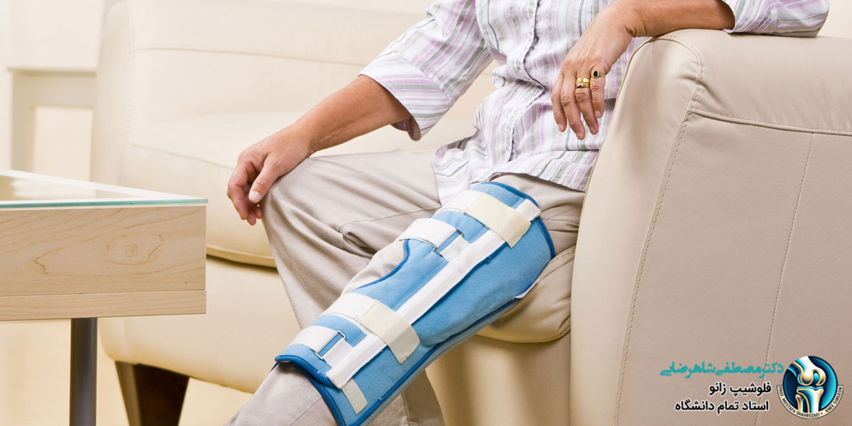 مراقبت های بعد از تعویض مفصل زانو