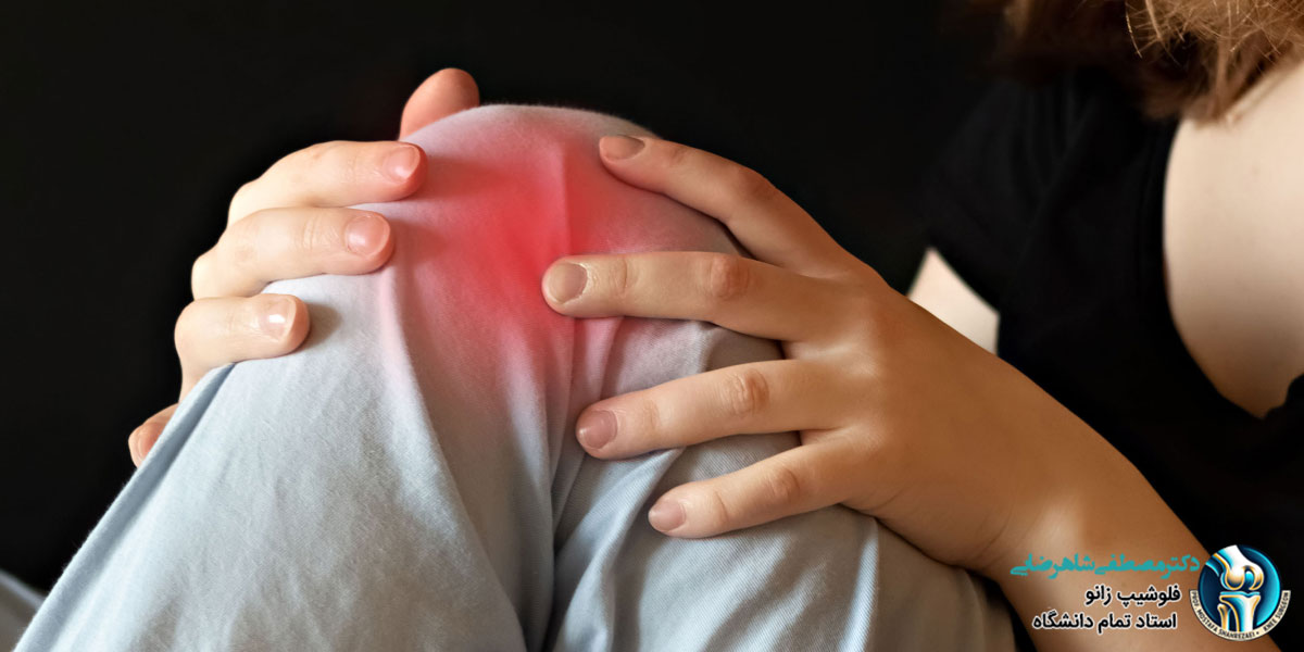 آیا آرتروز زانو، ارثی است
