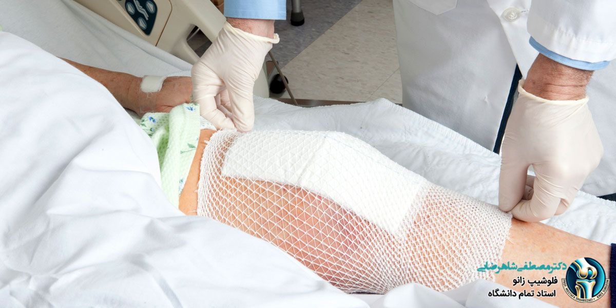 مزایای جراحی زانو به روش آرتروسکوپی