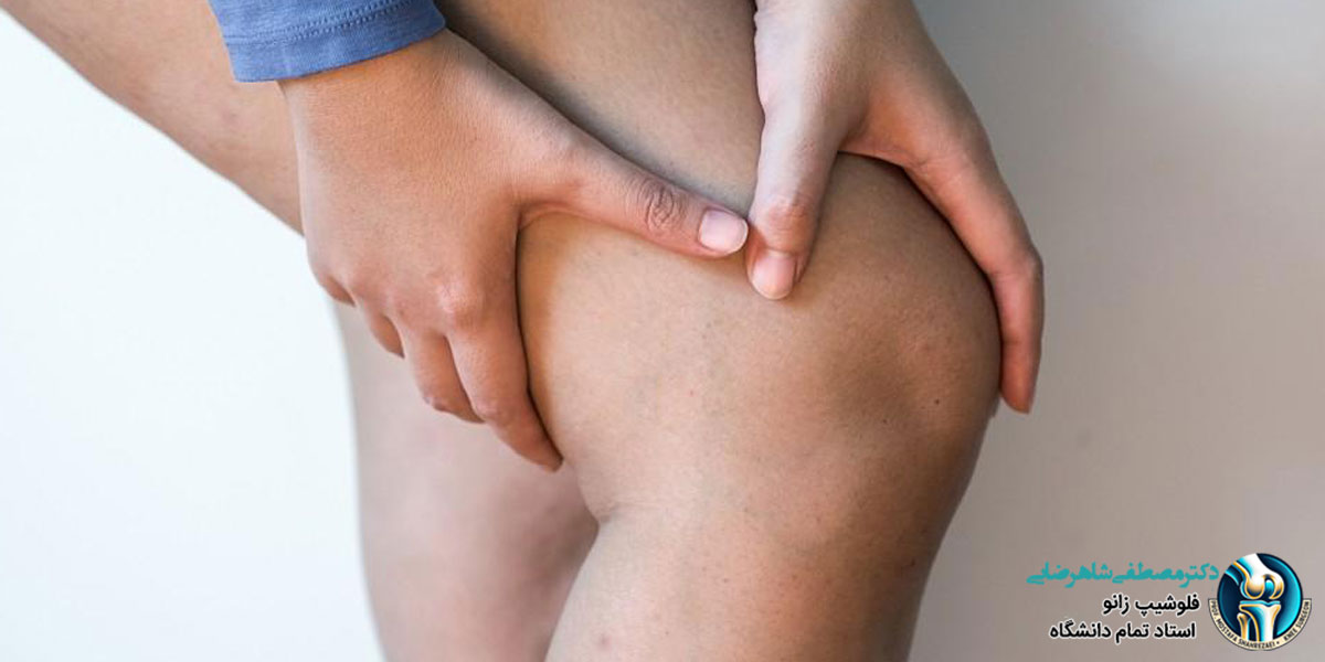 زانو درد عصبی چیست