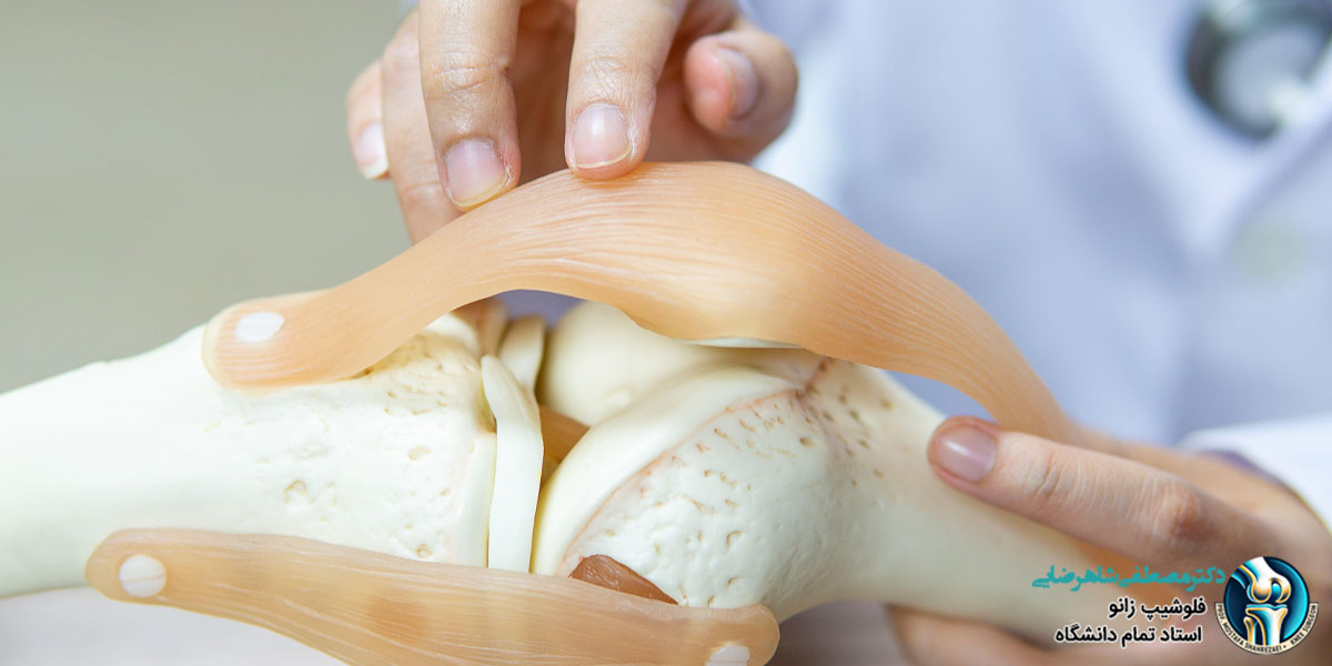 خونریزی مفصل زانو