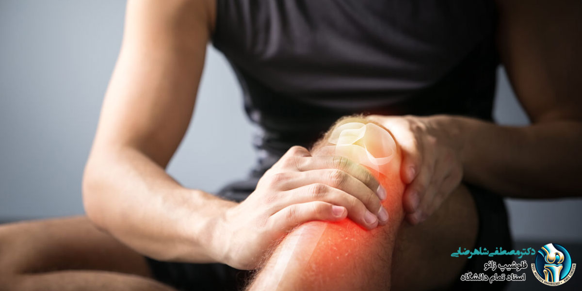 علت رگ به رگ شدن عضلات زانو