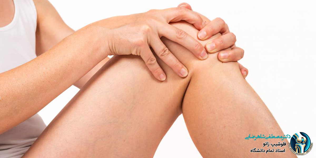 علت رگ به رگ شدن عضلات زانو