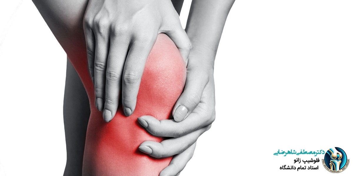 علائم بیماری های زانو