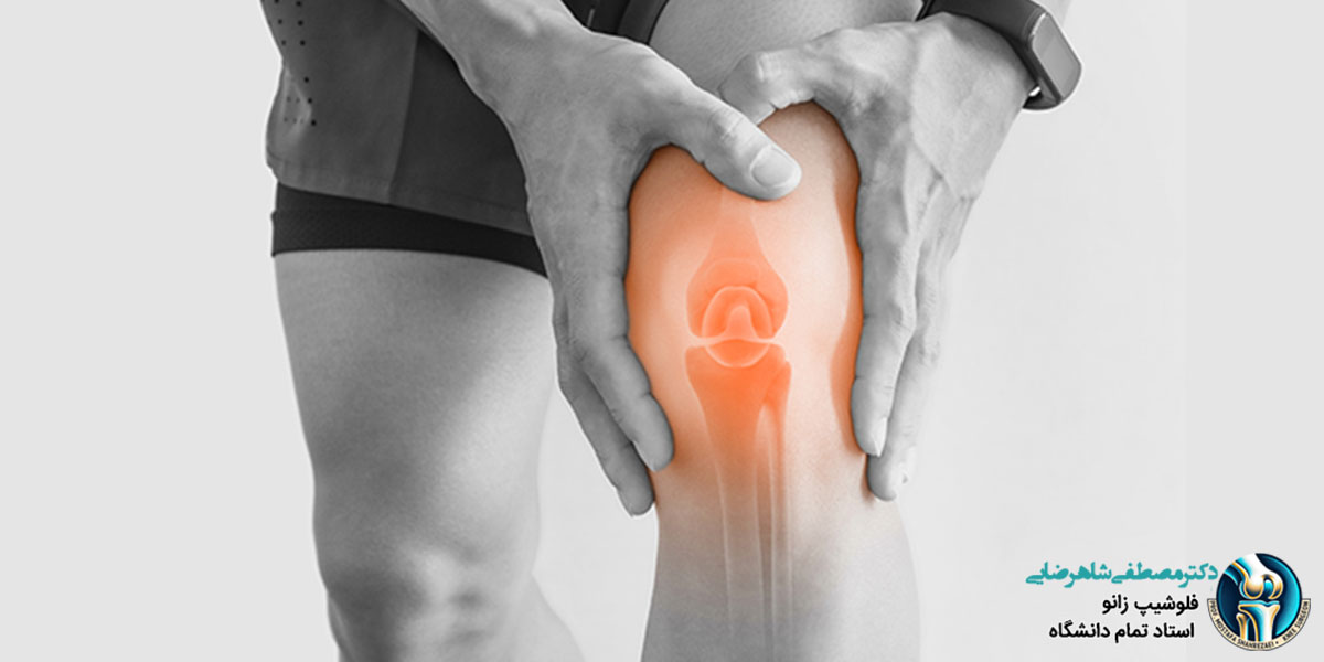 علت درد بالای زانو چیست