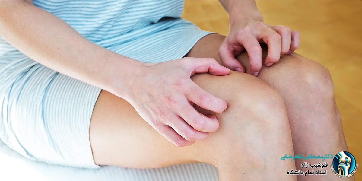 علت خارش زانو چیست