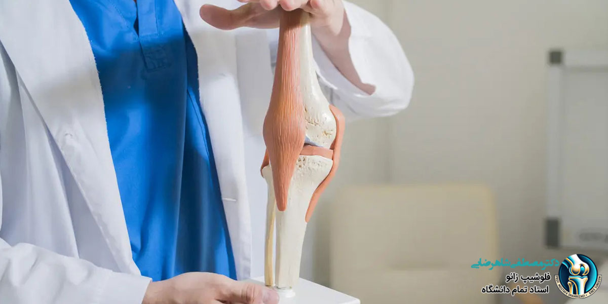 ملاحظات لازم جهت جراحی زانو