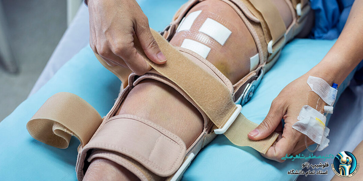 مراقبت های بعد از جراحی زانو