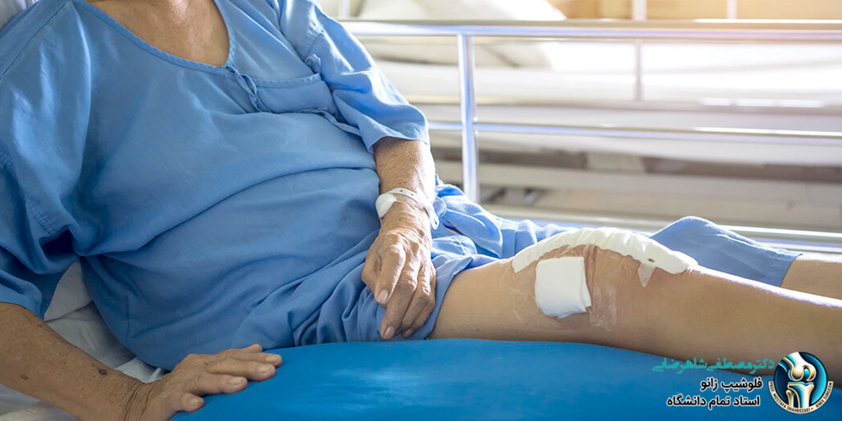 مراقبتهای قبل از جراحی زانو