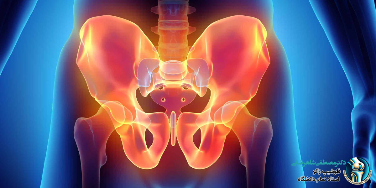دلایل شایع درد لگن