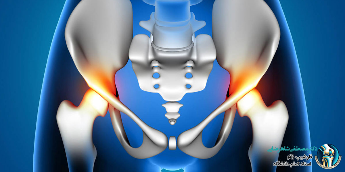 دلایل شایع درد لگن