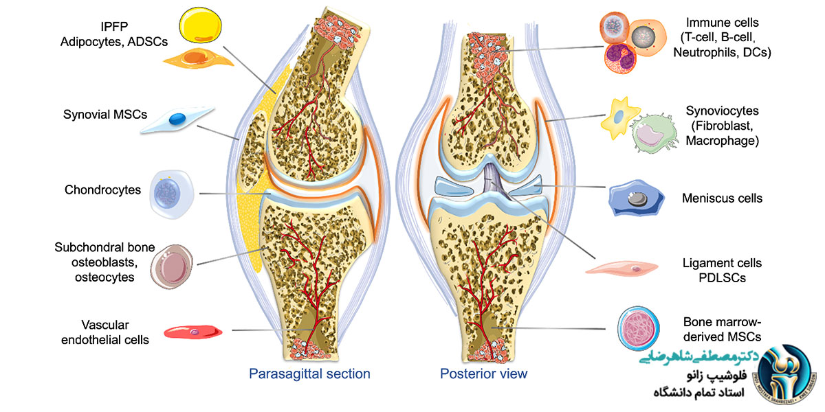 اگزوزوم‌ها؛ امیدی تازه برای زانوهای فرسوده یا افسانه‌ای نو؟