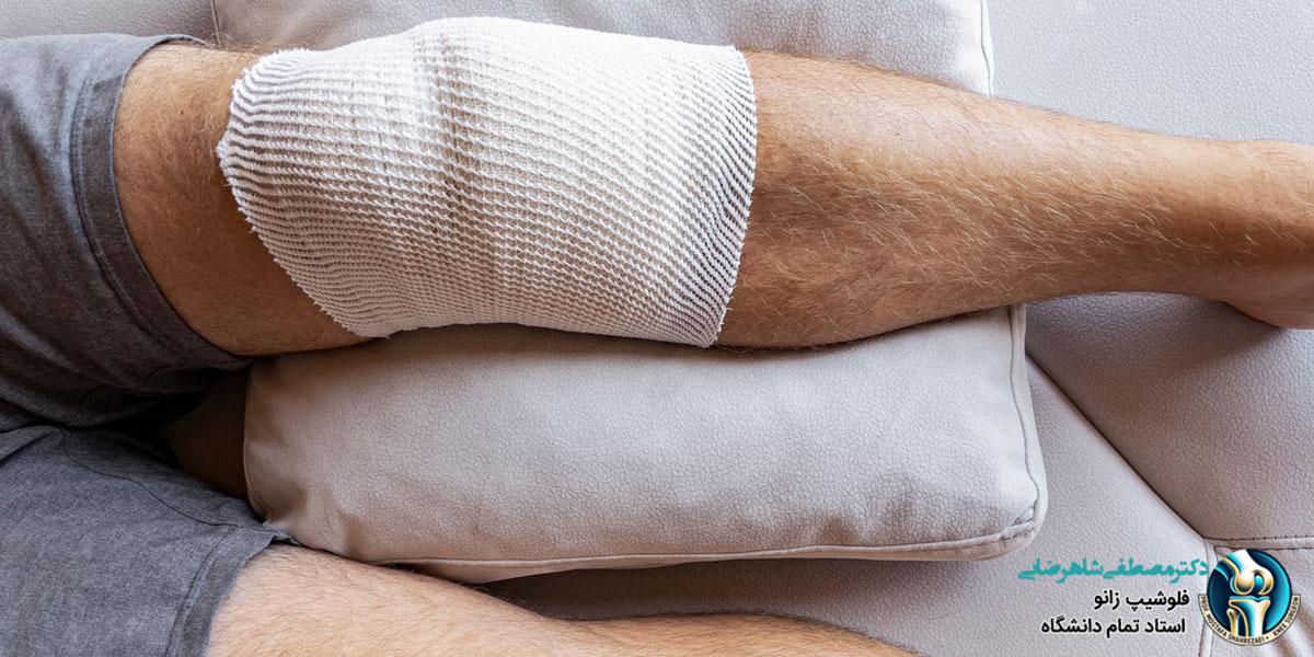 مراقبت‌های بعد از جراحی تعویض مفصل زانو