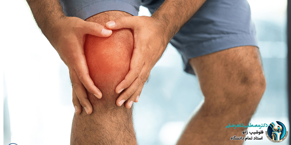 آمادگی های لازم جهت درمان رباط صلیبی
