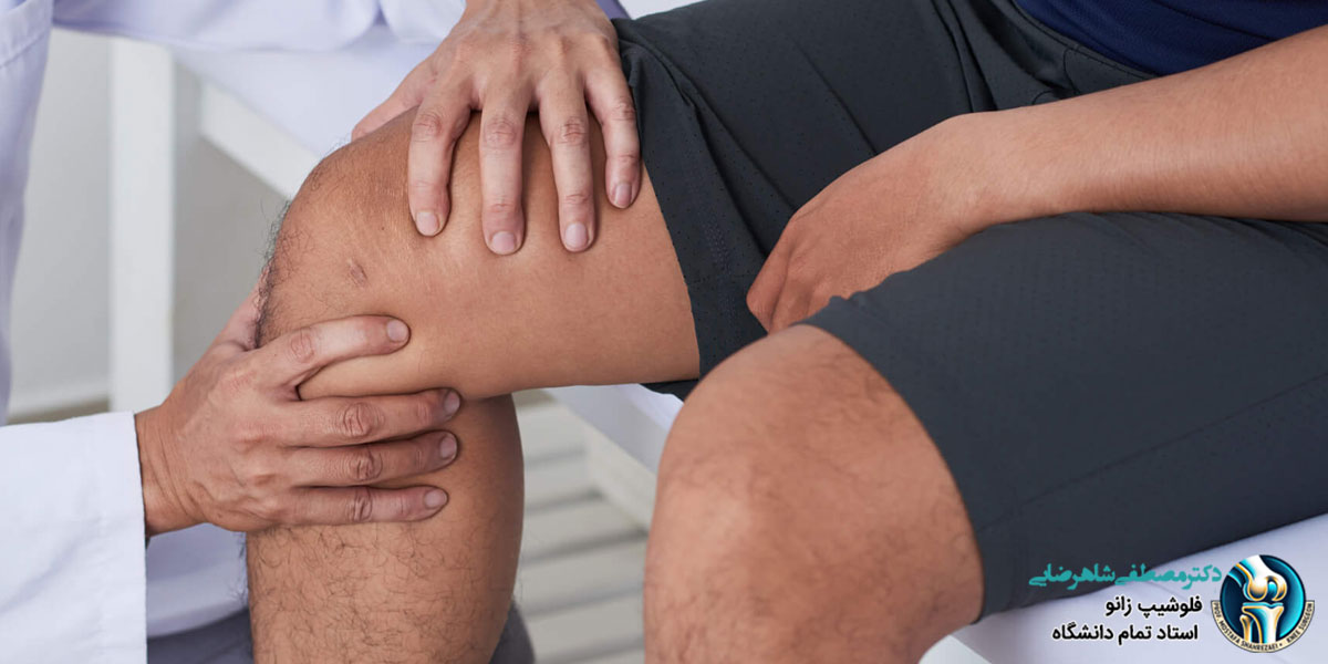 آمادگی های لازم برای جراحی زانو