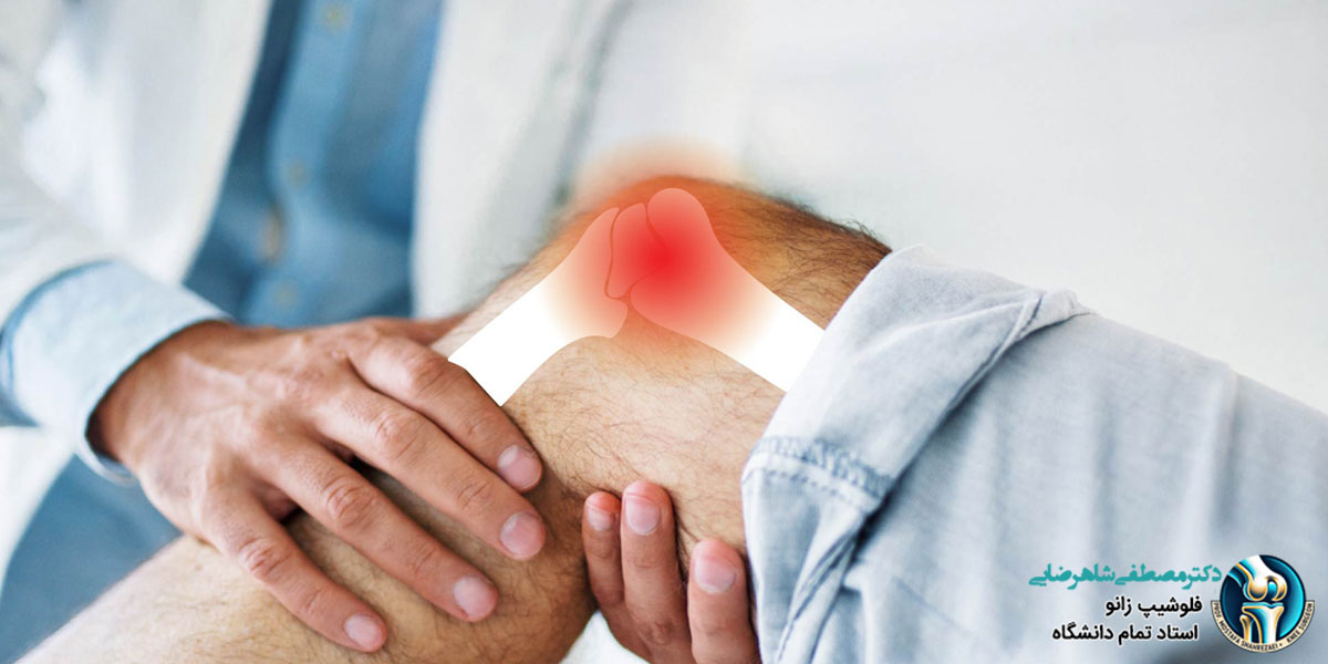 نشانه های خراب شدن مفصل زانو