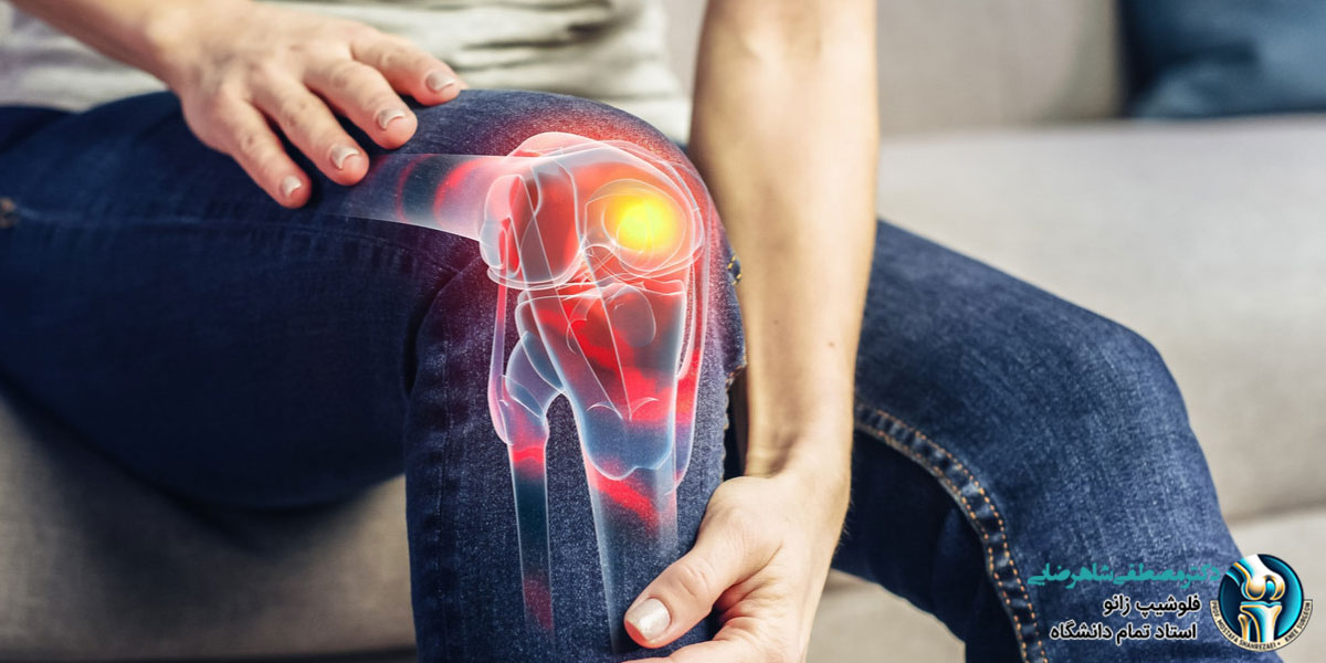 نشانه های خراب شدن مفصل زانو