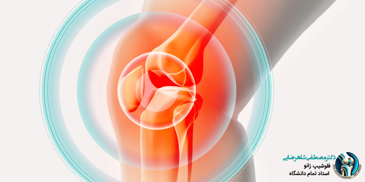 نشانه های خراب شدن مفصل زانو چیست