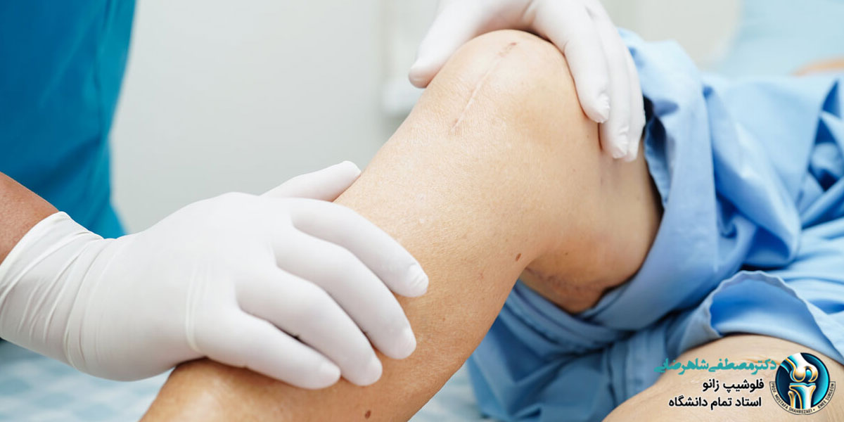 آیا تعویض مفصل زانو درد دارد