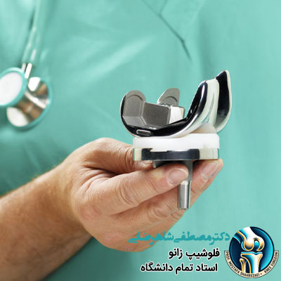 زانوی مصنوعی چقدر عمر می کند