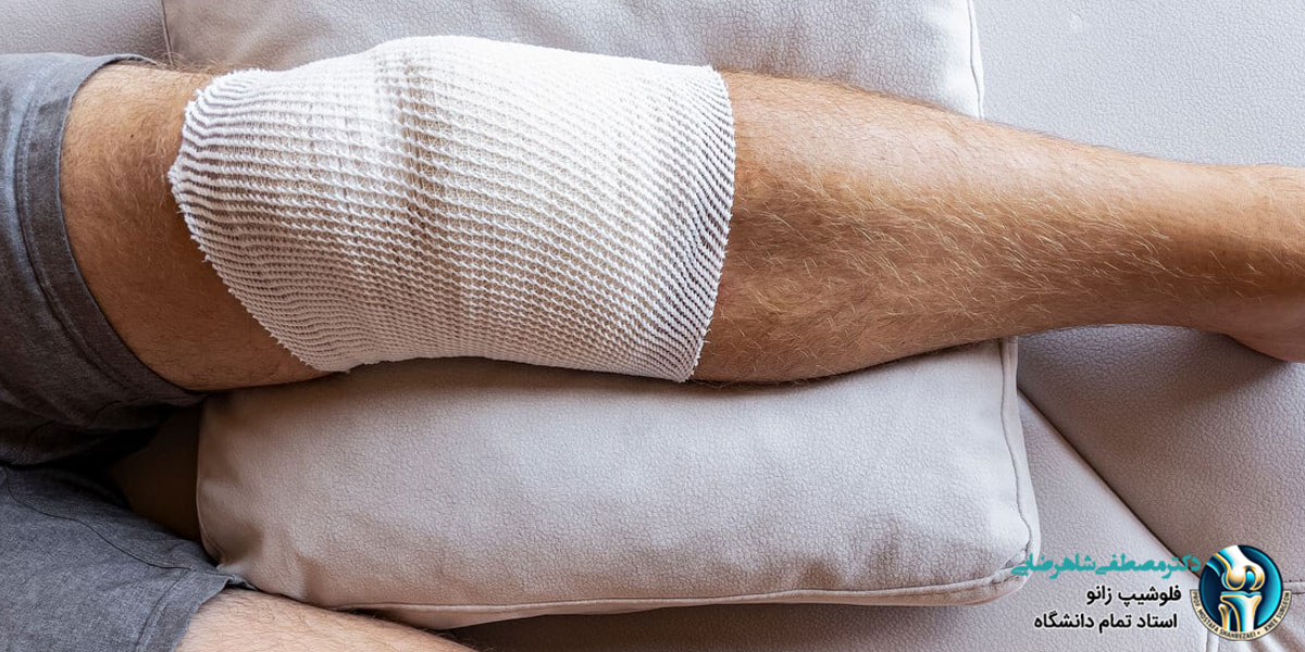 درد دوباره زانو بعد از جراحی