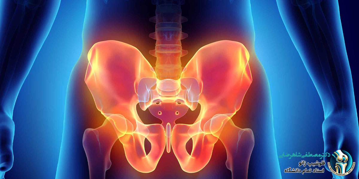 درد لگن در خواب