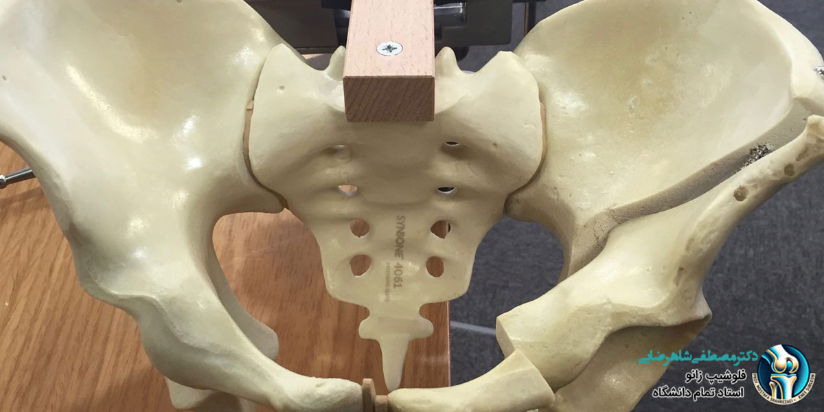 چه کسانی نباید جراحی لگن انجام بدهند