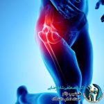 چه کسانی نباید جراحی لگن انجام بدهند