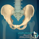 آیا لگن من به جراحی نیاز داره