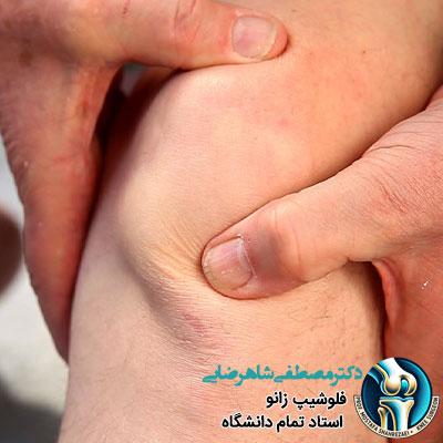 زانو درد شبانه
