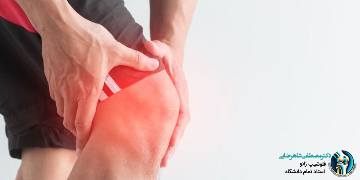 بررسی علائم مهم آسیب زانو پس از زمین خوردن