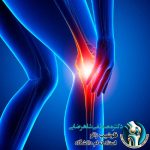 ۵ راهکار برای کنترل درد جلوی زانو