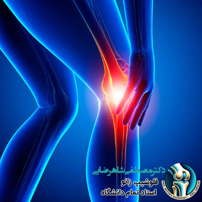 ۵ راهکار برای کنترل درد جلوی زانو